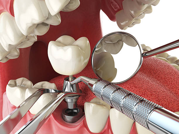 Best Dentist for Tooth Abscess  in Martsville, IN